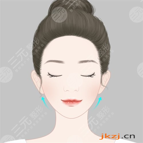 厦门大学附属第一医院整形美容烧伤科光子嫩肤案例分享：术后