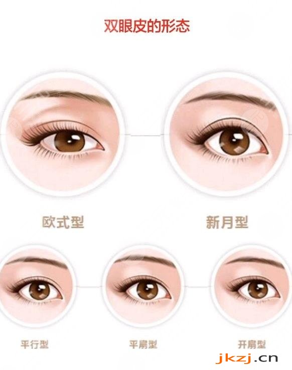 双眼皮修复