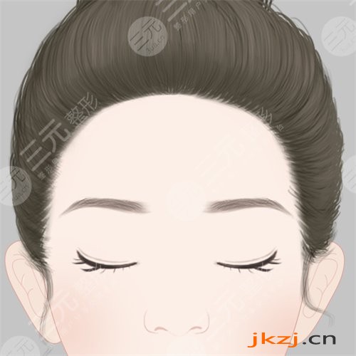 脂肪填充太阳穴案例