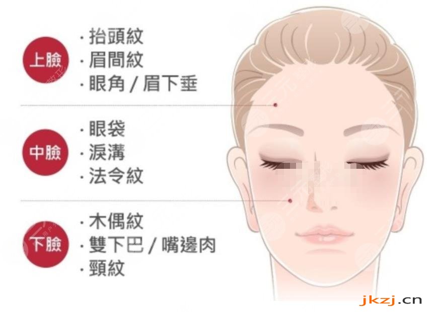 拉皮手术相关知识科普问答