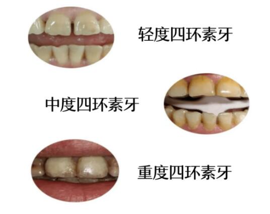 北京中科领军口腔医院治疗效果如何？详细地址&专家团队情况&值得信赖的牙科医生