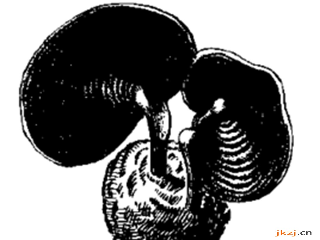 密纹薄芝