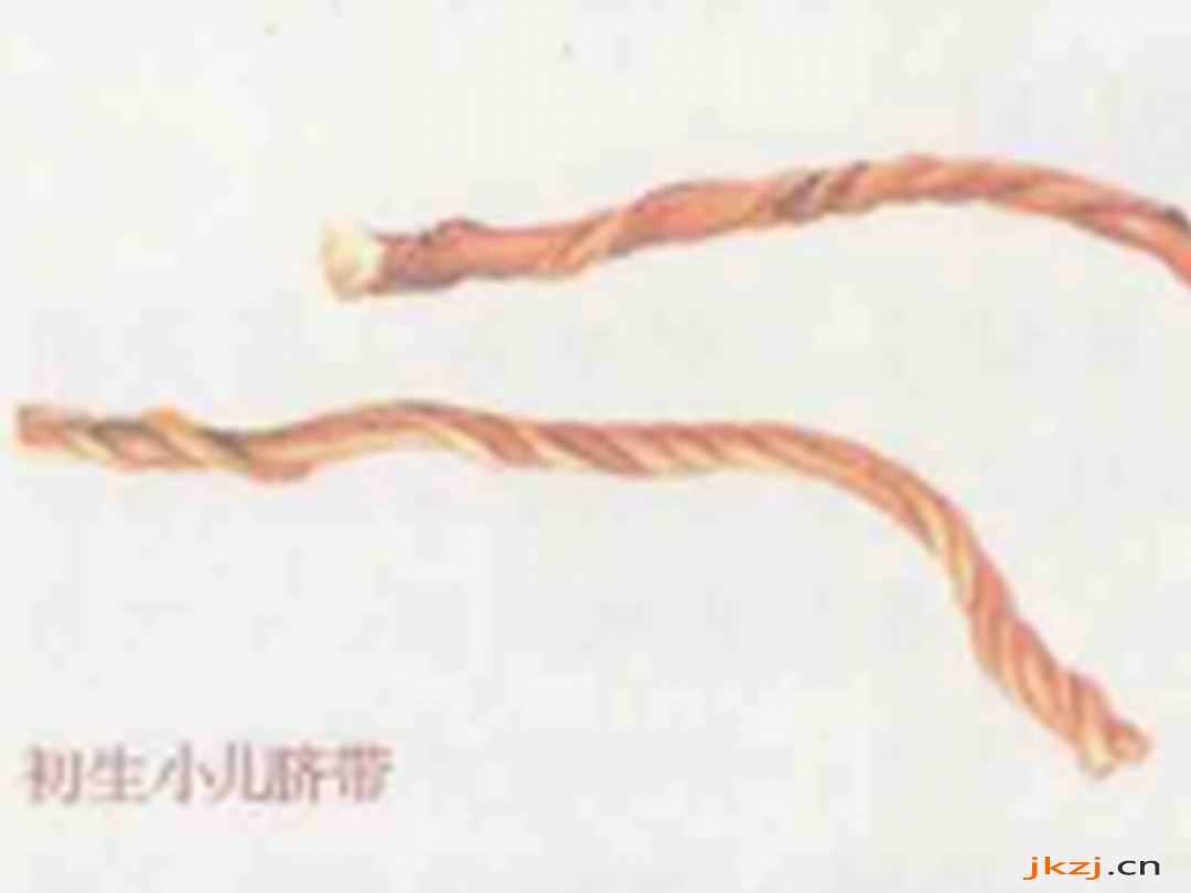 脐带