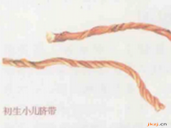 脐带的功效与作用，脐带的图片，脐带用法及注意事项