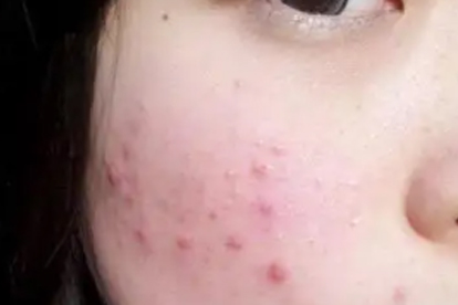 皮肤科