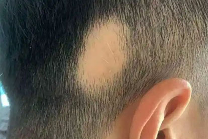 皮肤科