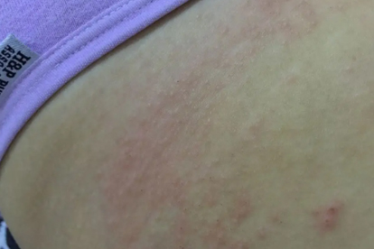 皮肤科