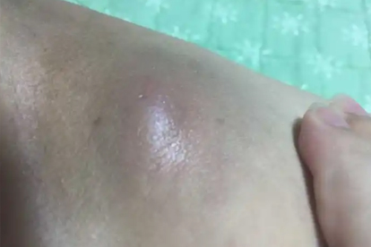 皮肤科