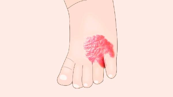 肿瘤科