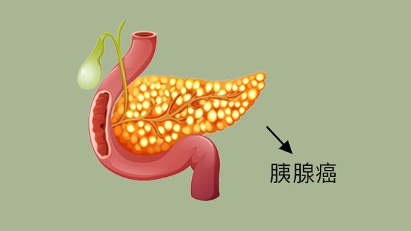 肿瘤科